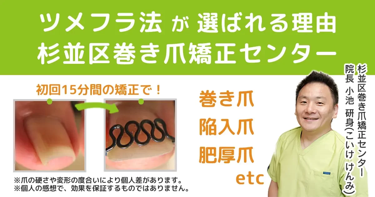 東京でおすすめ 人気の東京巻き爪治療 専門情報 サロン 人気おすすめドットコム